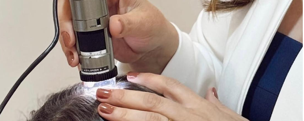 Tricoscopia Digital Exame não invasivo, rápido, indolor e de alta precisão que permite avaliar o couro cabeludo e os fios em detalhes. Identifica tipos de alopecia, grau de inflamação, presença de miniaturização dos fios, oleosidade, descamação e outros fatores que impactam o crescimento capilar